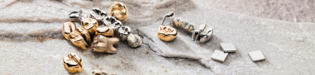 Verschiedene Zahngoldreste, Goldkronen und Dentallegierungen auf einer hellen Steinoberfläche. Die Aufnahme symbolisiert den Zahngoldankauf in Kassel sowie die professionelle Analyse, Wertermittlung und den Ankauf von Zahngold und dentalen Edelmetallen.