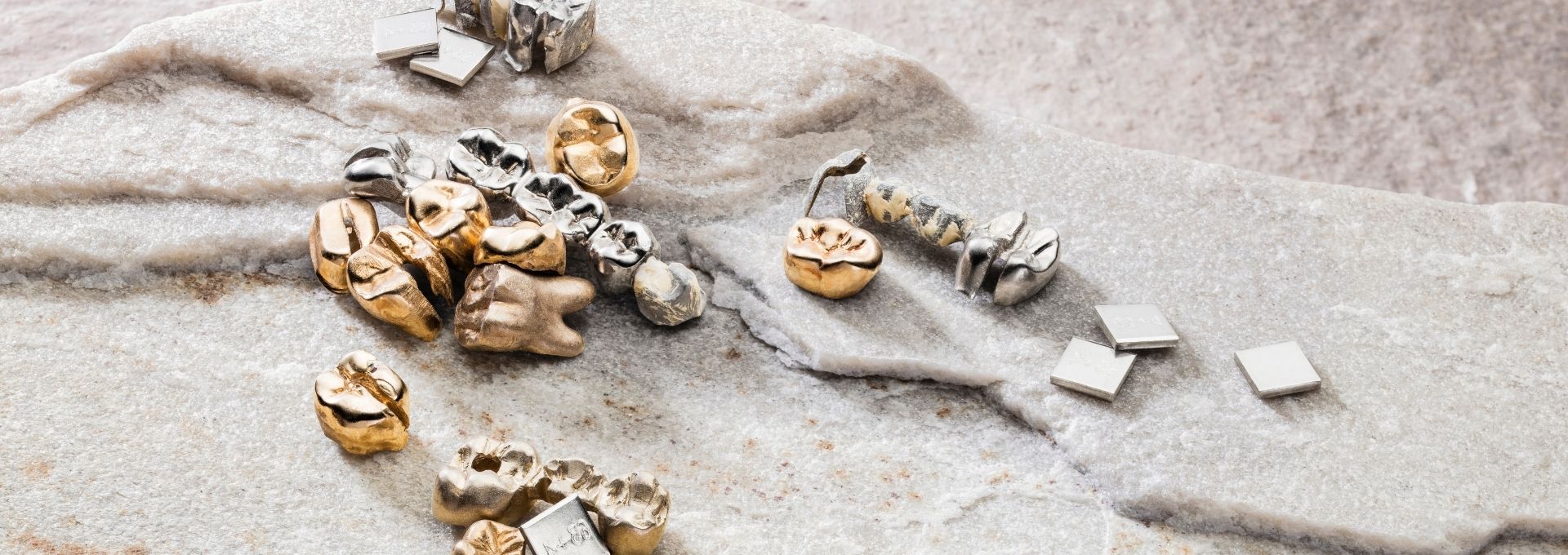 Zahngold, Dentalgold und Zahnkronen aus edelmetallhaltigen Legierungen in Detailansicht. Die Darstellung veranschaulicht den Zahngoldankauf und die fachgerechte Bewertung von Zahngold anhand des enthaltenen Edelmetallgehalts.